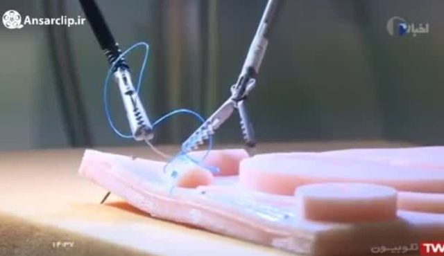 جراحی رباتیک از راه دور – ساخت ایران
